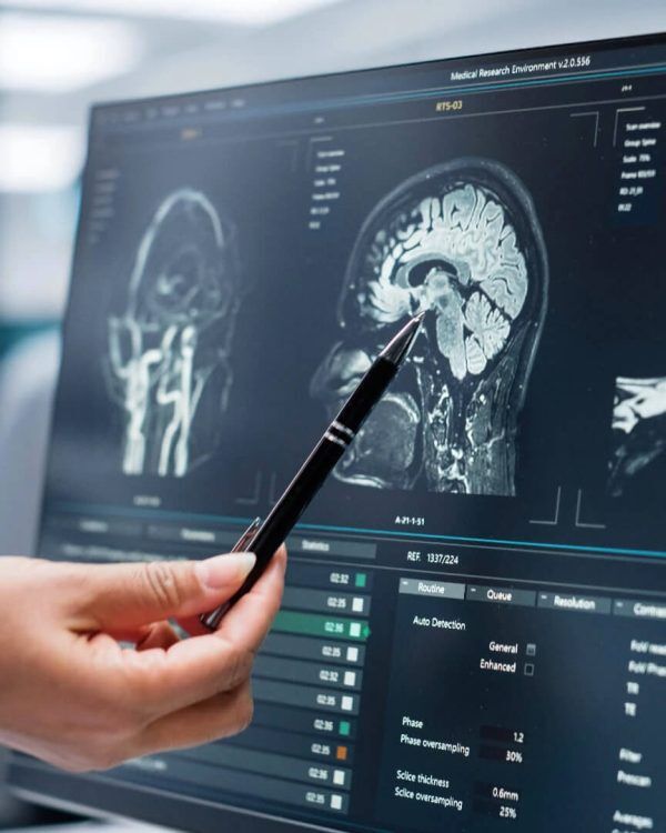 Neurological Neurology Assessment Synoptic Medical 8261